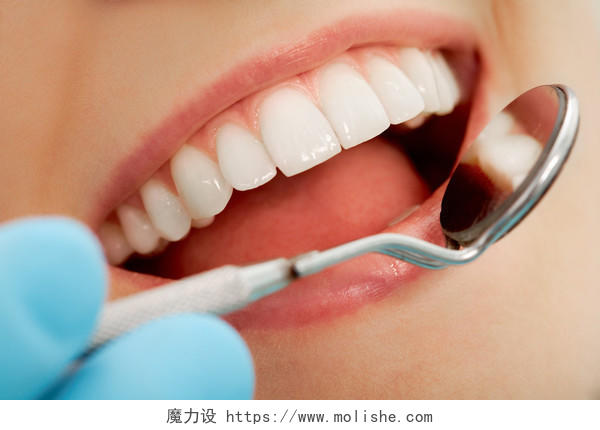 做口腔检查时美丽健康的牙齿和镜像口牙齿美白